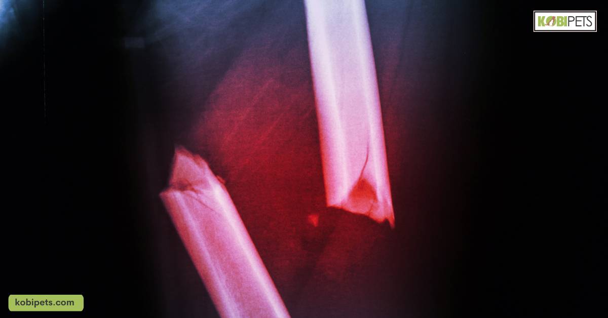Fracture