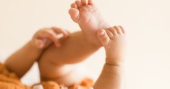 Serial Casting vs. UNFO Brace: What Parents Need to Know About MTA Treatment