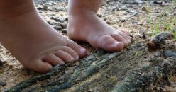 Tiny Toes, Big Steps: When to Start Forefoot Adduction Care and What Happens Next
